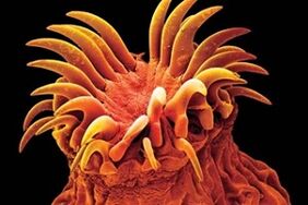 人体吸虫寄生虫