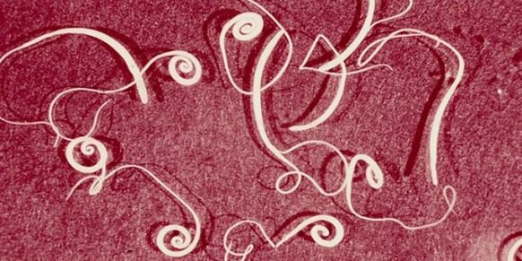 人体寄生虫照片