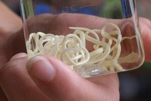 来自人体的寄生虫