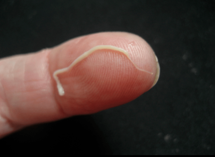 来自人体的蛔虫寄生虫